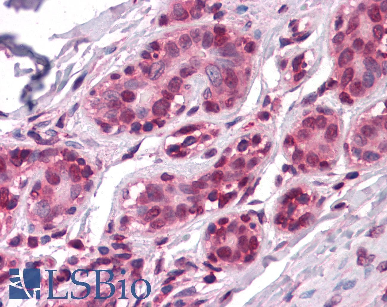 IHC-plus™ Monoclonal Mouse anti-Human GATA3 Antibody (clone 7B5, IHC, WB)