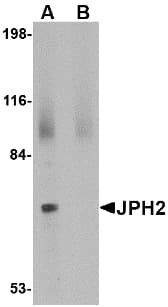 Junctophilin 2 / JPH2 Antibody
