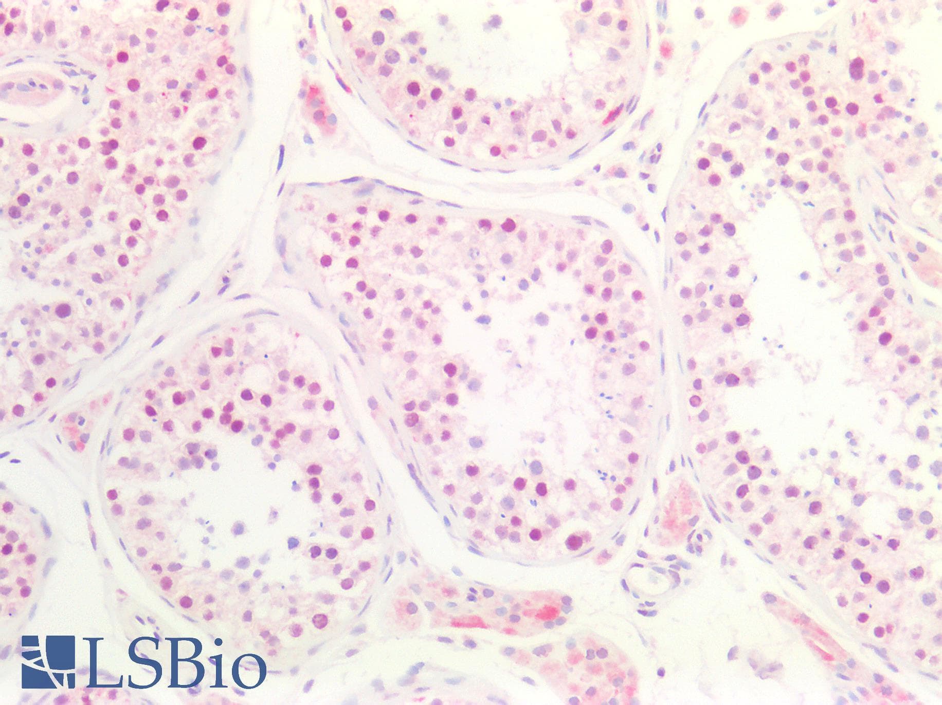 PathPlus™ MEN1 / Menin Antibody (aa575-C-term)