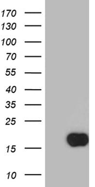 TFF1 / pS2 Antibody (aa25-84, clone OTI1F5)