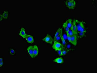 MAS1 / MAS Antibody (aa285-352)