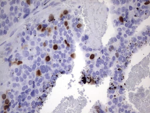 TOP2A / Topoisomerase II Alpha Antibody (aa1100-1531, clone UMAB146)