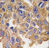 AKT2 Antibody (Ser474)