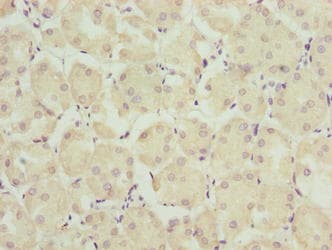 TRAPPC6B Antibody