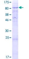 Human CCIN / Calicin Protein (Recombinant GST)