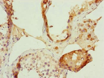 FBXL5 / FBL5 Antibody