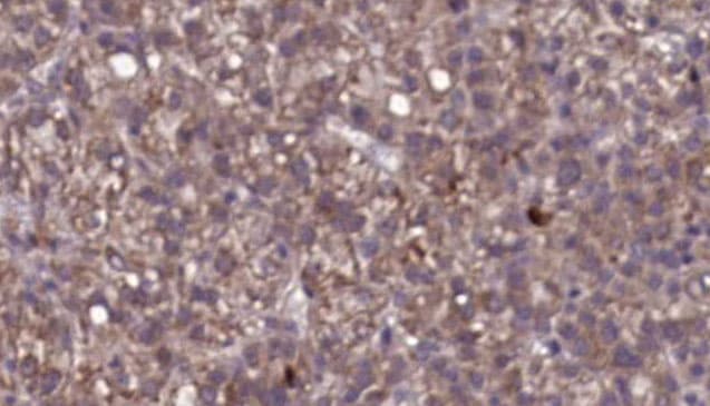 IL23R Antibody