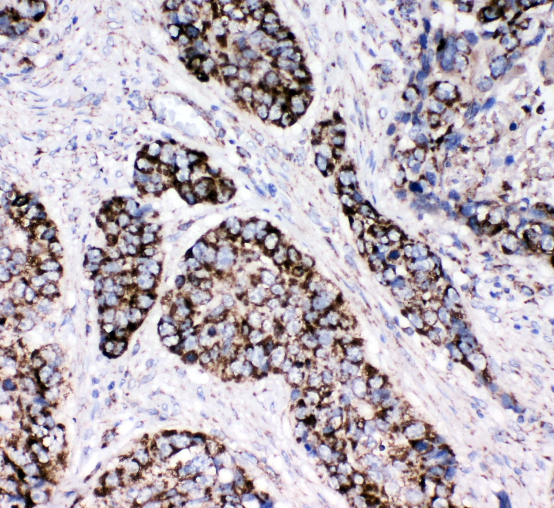 Polyclonal Rabbit anti-Human PRDX3 / Peroxiredoxin 3 Antibody (aa239-256, IHC, WB)