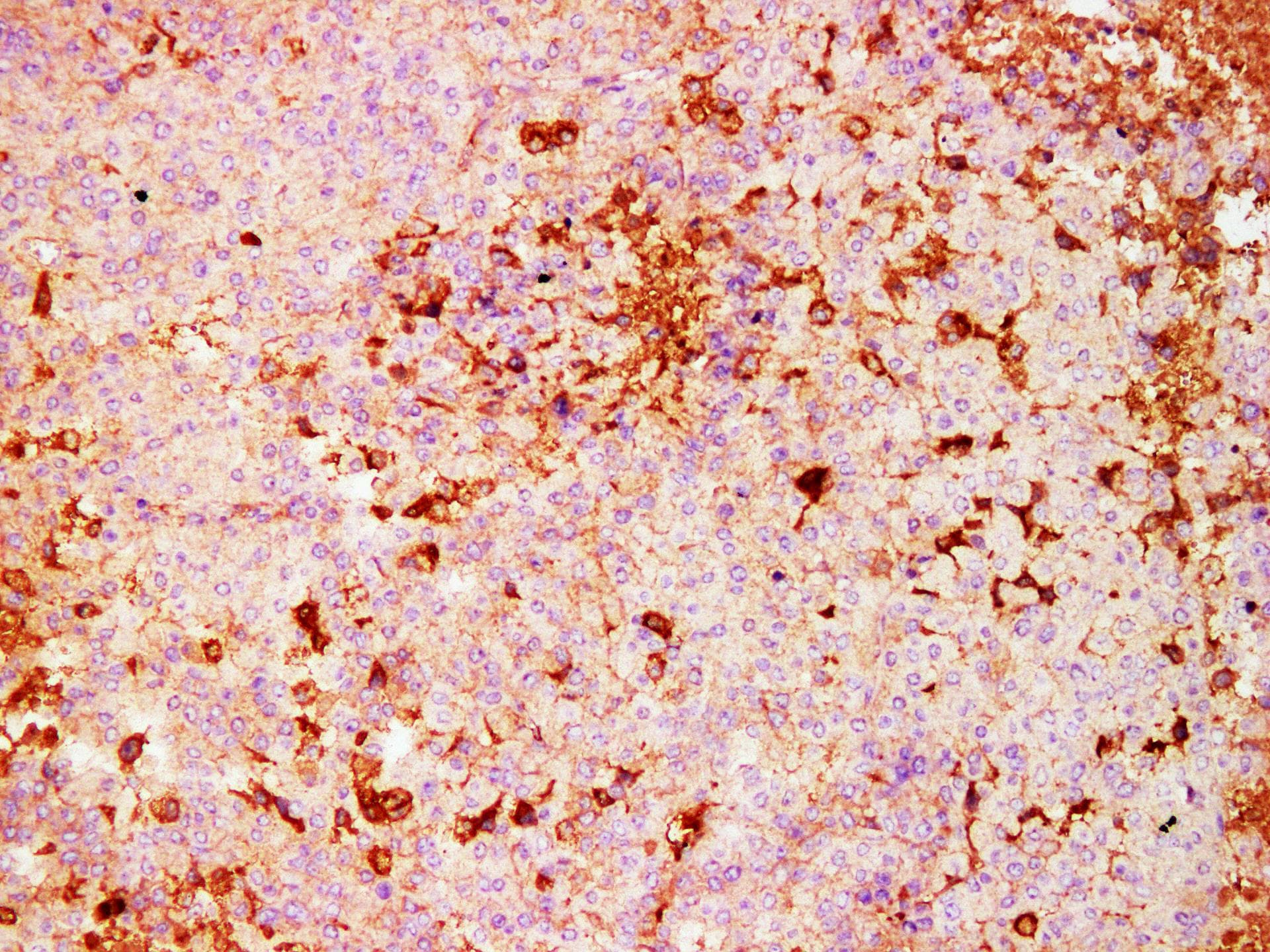 S100A4 / FSP1 Antibody
