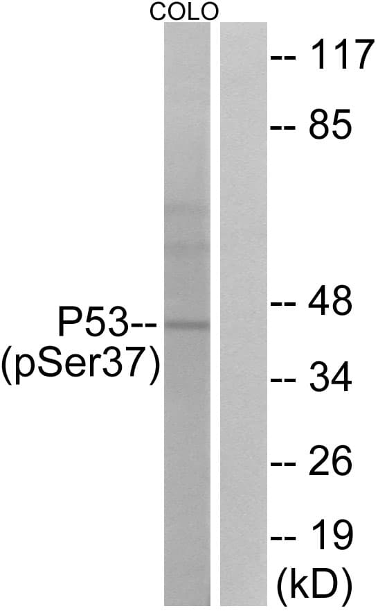 TP53 / p53 Antibody (phospho-Ser37)