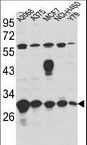 ERP29 Antibody (aa151-179)