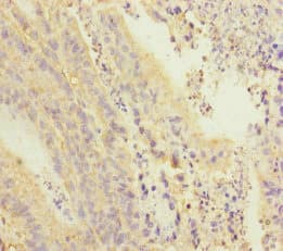 PDE6A / PDE6 Alpha Antibody