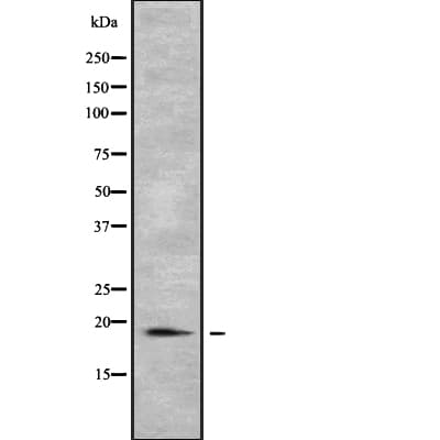 Polyclonal Rabbit anti-Human PTRH2 / BIT1 Antibody (WB)