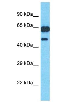 Polyclonal Rabbit anti-Human PM20D1 Antibody (aa25-74, WB)