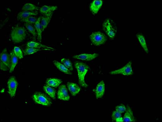 CLEC7A / Dectin 1 Antibody
