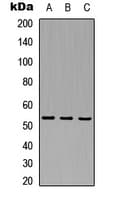 MAP3K8 / TPL2 Antibody (Internal)