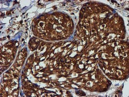 PSMB9 Antibody (clone OTI2B6)