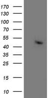 ACY1 / Aminoacylase 1 Antibody (clone OTI1D4)