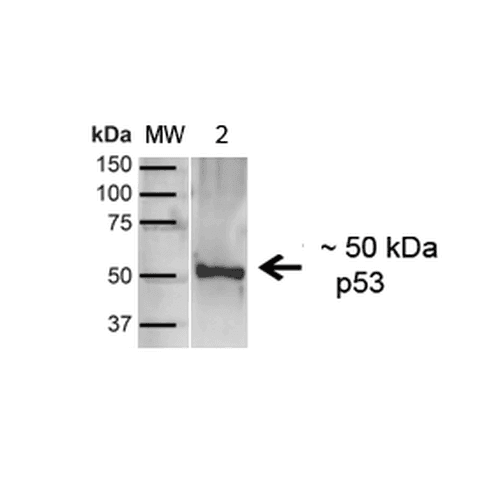 TP53 / p53 Antibody
