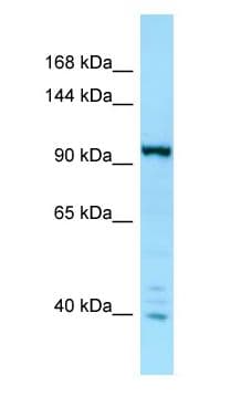 IPO7 / RANBP7 Antibody (aa560-609)