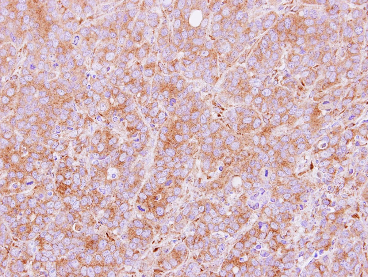 Polyclonal Rabbit anti-Human PDIA5 / PDIR Antibody (aa1-253, IHC, WB)