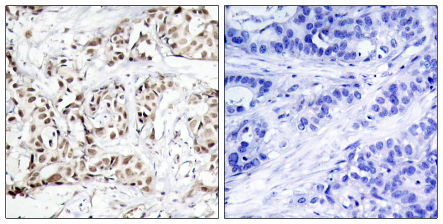 JNK1+2+3 Antibody (phospho-Thr183)