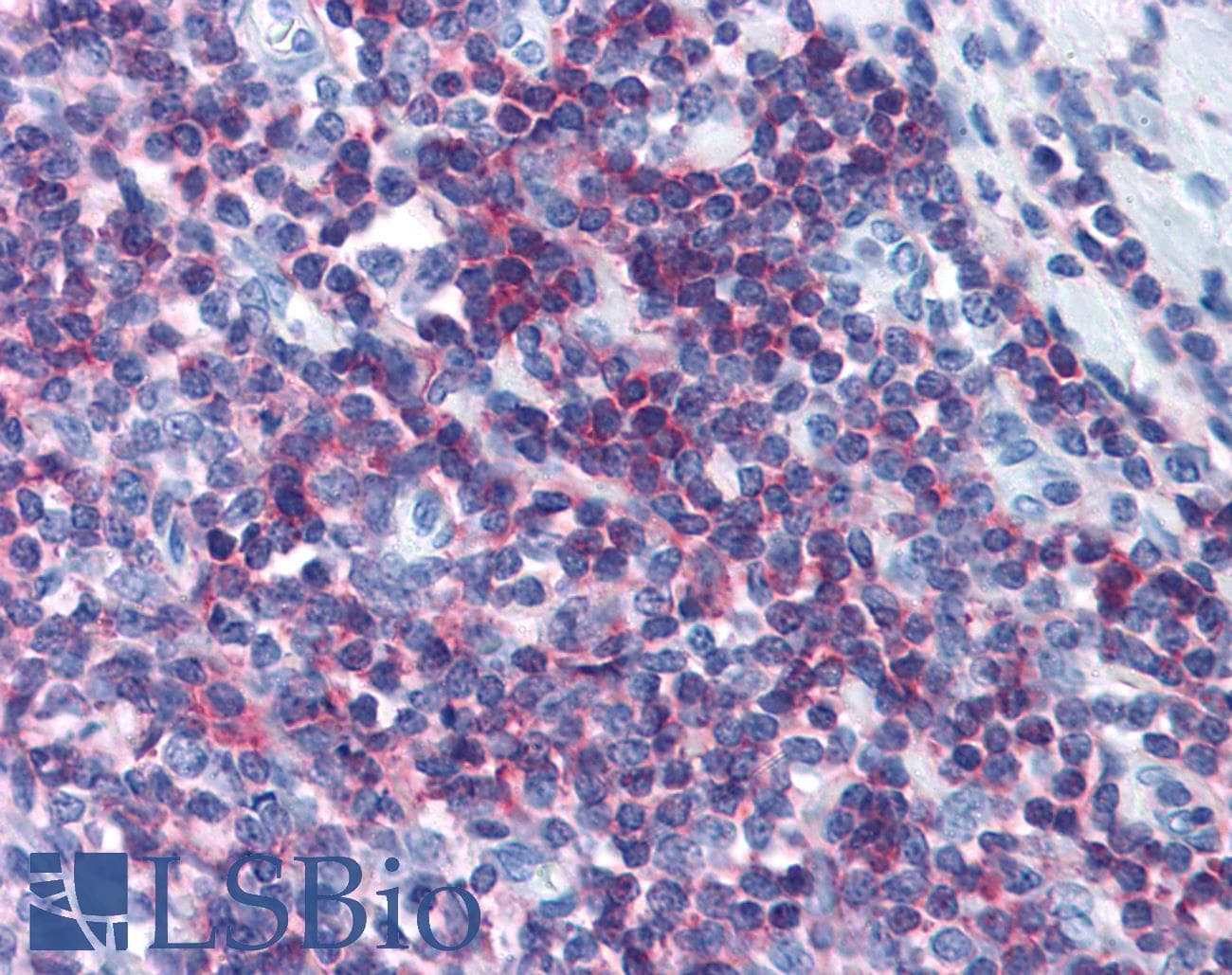 IHC-plus™ CD45 / LCA Antibody (clone F10-89-4, FITC)