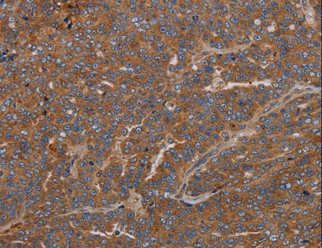 GDF2 / BMP9 Antibody (aa413-425)
