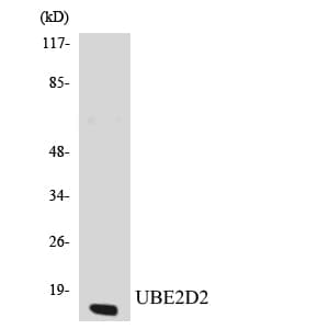 Polyclonal Rabbit anti-Human UBE2D2 / UBCH5B Antibody (aa90-139, WB)