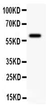 KCNN4 / KCa3.1 Antibody (aa11-28)