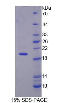 Human RGS7 Protein (Recombinant)