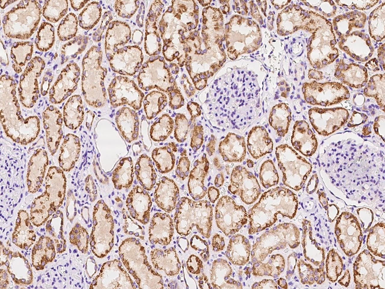 Polyclonal Rabbit anti-Human TWIK1 / KCNK1 Antibody (IHC)