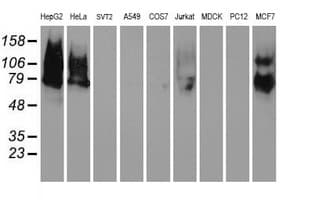 Monoclonal Mouse anti-Human MAC-2-BP / LGALS3BP Antibody (clone OTI6B7, IHC, WB)
