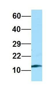 RPL36AL Antibody (C-Terminus)