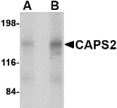 IHC-plus™ Polyclonal Rabbit anti-Human CAPS2 Antibody (IHC, IF, WB)