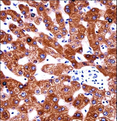 Polyclonal Rabbit anti-Human CYB5A / Cytochrome b5 Antibody (aa69-98, IHC, WB)