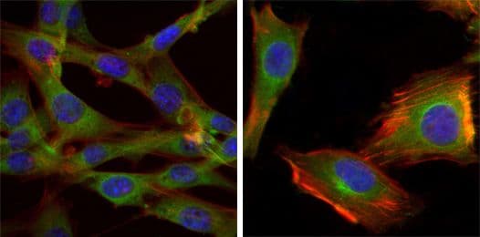 GSK3B / GSK3 Beta Antibody (clone 3D10)