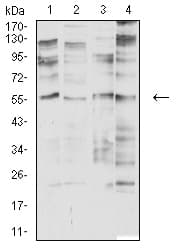 Monoclonal Mouse anti-Human CHRNA2 Antibody (clone 7G12H9, WB)