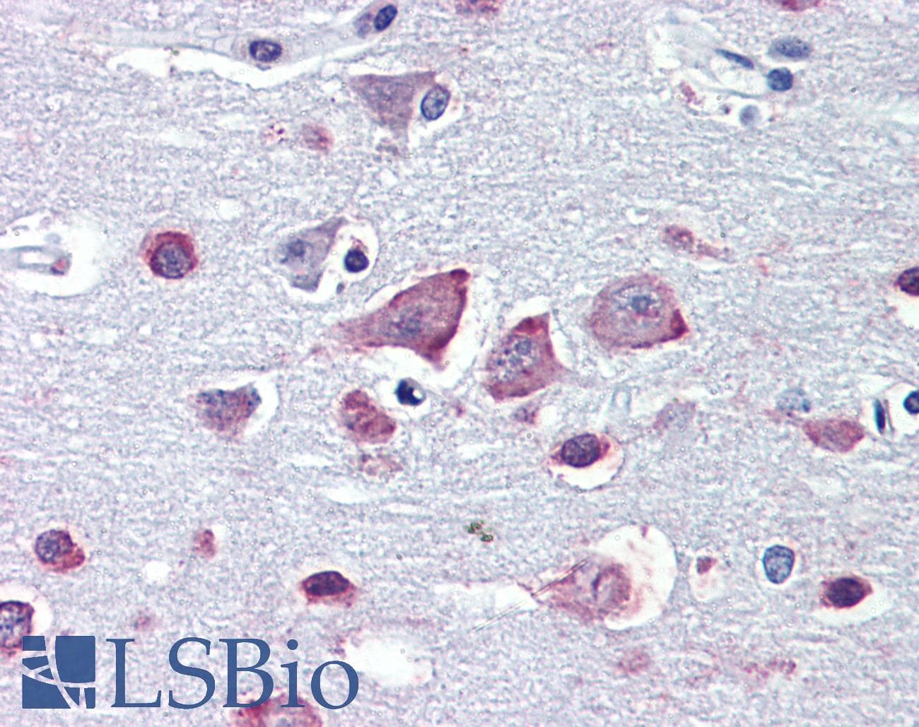 PathPlus™ GABRA4 Antibody (aa349-361)