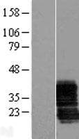 ZCRB1 Protein (Over-Expression Lysate Myc-DDK (Flag))