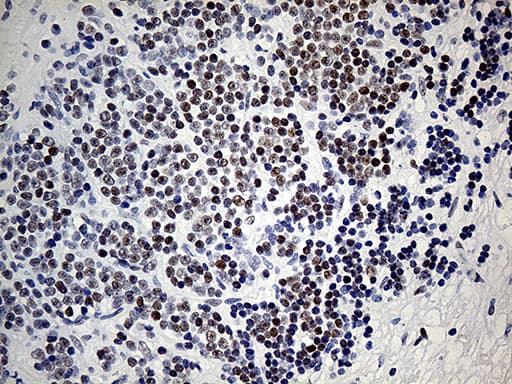 KDM3A / JMJD1A Antibody (aa850-1321, clone OTI5A7)