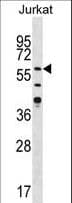 Polyclonal Rabbit anti-Human CAMK2G / CaMK II Gamma Antibody (aa309-338, IHC, WB)