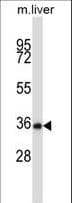 NEK6 Antibody (aa251-280)