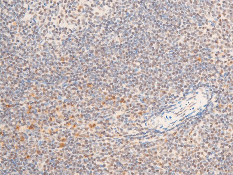 Polyclonal Rabbit anti-Human NTRK1 / TrkA Antibody (phospho-Tyr680,phospho-Tyr681, IHC, WB)