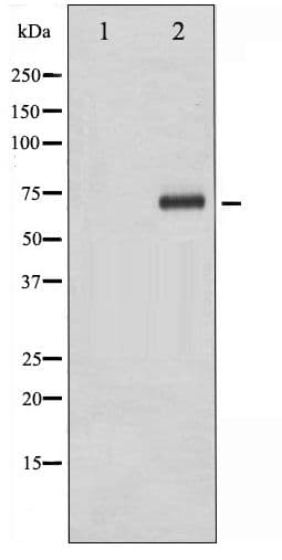 RPS6KB1 / P70S6K / S6K Antibody (phospho-Thr229)