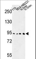 Polyclonal Rabbit anti-Human Dipeptidylpeptidase 10 / DPP10 Antibody (aa150-177, IHC, WB)