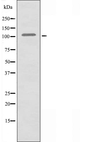 ACTN2 Antibody