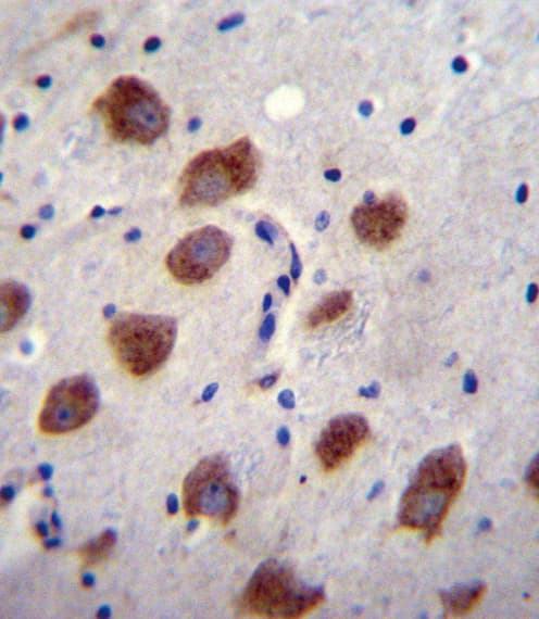 ALK-6 / BMPR1B Antibody (aa134-162)