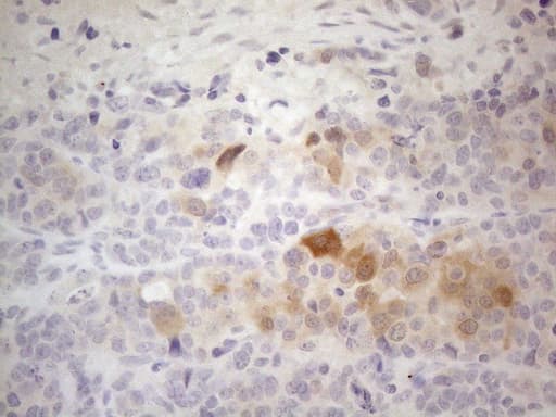 PDIA6 / ERP5 Antibody (clone OTI2H3)
