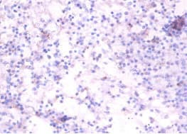 TNFRSF19L / RELT Antibody